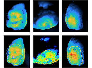 Scans of tumors using fluorescent molecules. Some scans show drawn boundaries that mark regions of interest. 