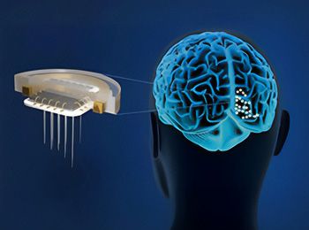 Imagery of brain to demonstrate Wireless Visual Prosthesis Brain Implant